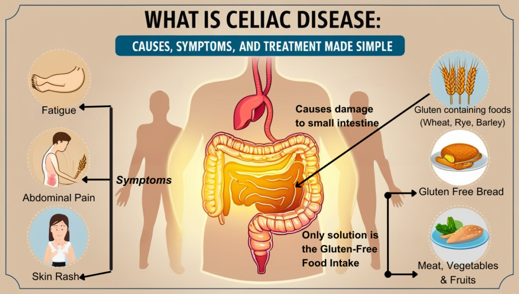 What-is-Celiac-Disease