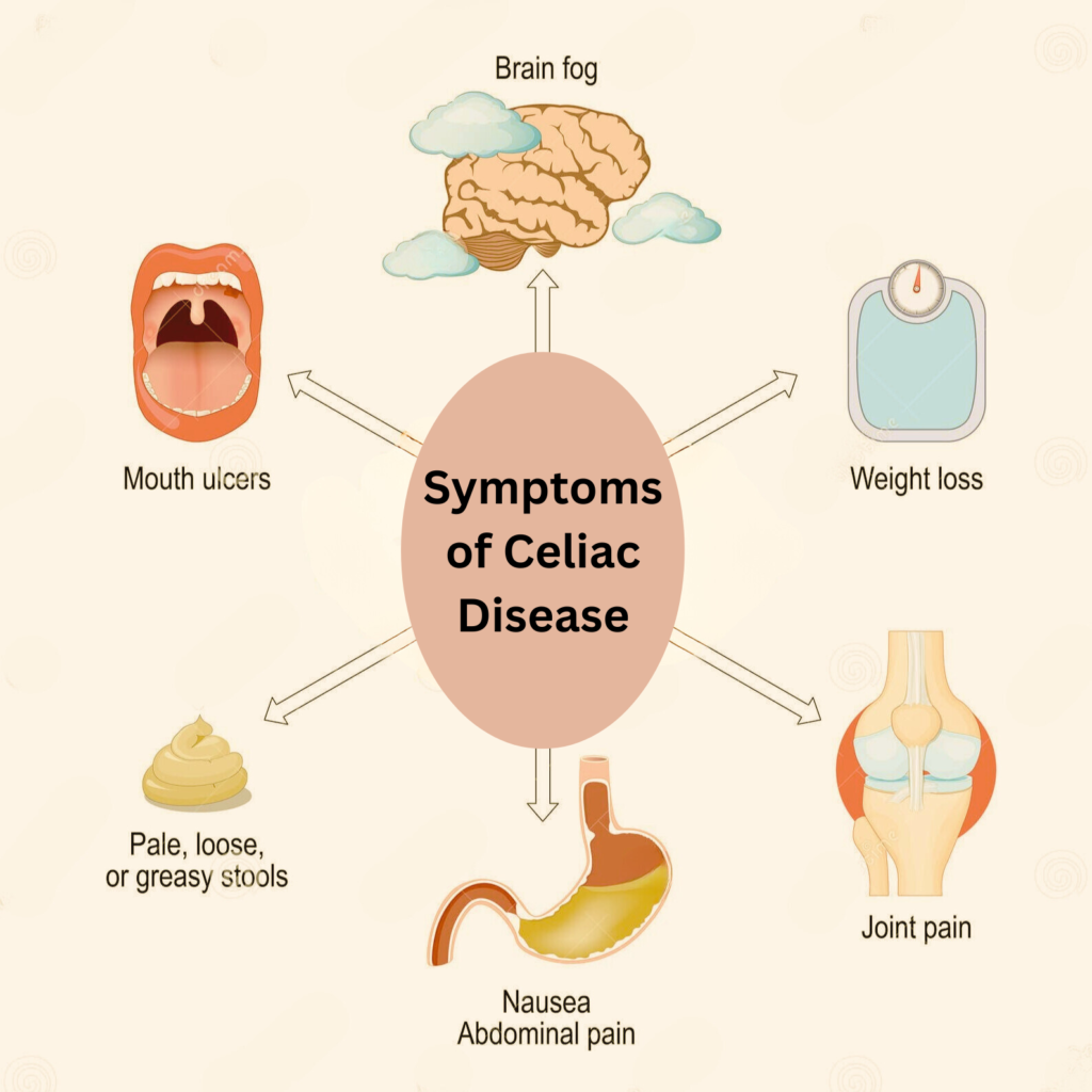 Discover the Key Symptoms of Celiac Disease